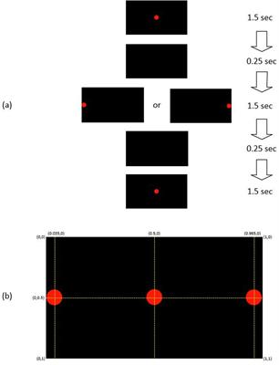 Reflexive eye saccadic parameters in Parkinson’s disease